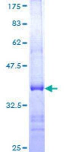 Novus Biologicals Recombinant Human USP21 GST (N-Term) Protein 10 &mu;g | Buy Online | Novus Biologicals&trade; | Fisher Scientific