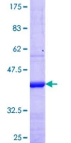 Novus Biologicals Recombinant Human Kv8.1 GST (N-Term) Protein 25 &mu;g | Buy Online | Novus Biologicals&trade; | Fisher Scientific