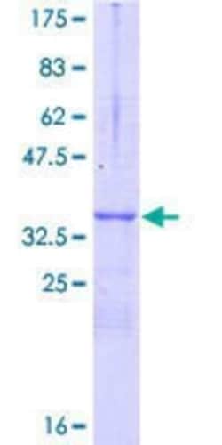 Novus Biologicals Recombinant Human NGFRAP1/BEX3/NADE GST (N-Term) Protein 10 &mu;g | Buy Online | Novus Biologicals&trade; | Fisher Scientific