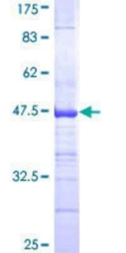 Novus Biologicals Recombinant Human NGFRAP1/BEX3/NADE GST (N-Term) Protein 10 &mu;g | Buy Online | Novus Biologicals&trade; | Fisher Scientific