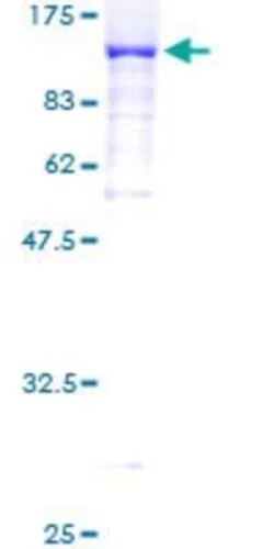 Novus Biologicals Recombinant Human DNAI1 GST (N-Term) Protein 10 &mu;g | Buy Online | Novus Biologicals&trade; | Fisher Scientific