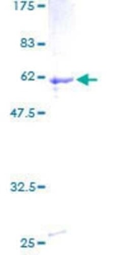 Novus Biologicals Recombinant Human TZFP GST (N-Term) Protein 2 &mu;g | Buy Online | Novus Biologicals&trade; | Fisher Scientific