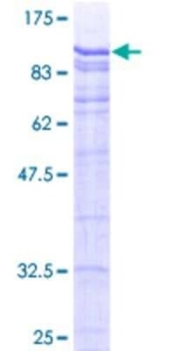 Novus Biologicals Recombinant Human HTF9C GST (N-Term) Protein 2 &mu;g | Buy Online | Novus Biologicals&trade; | Fisher Scientific