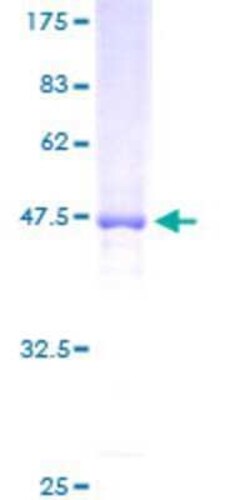 Novus Biologicals Recombinant Human D4S234E GST (N-Term) Protein 25 &mu;g | Buy Online | Novus Biologicals&trade; | Fisher Scientific