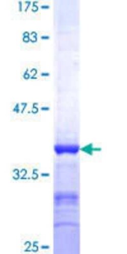 Novus Biologicals Recombinant Human STAU2 GST (N-Term) Protein 25 &mu;g | Buy Online | Novus Biologicals&trade; | Fisher Scientific