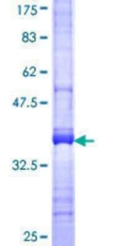 Novus Biologicals Recombinant Human DAPP1 GST (N-Term) Protein 25 &mu;g | Buy Online | Novus Biologicals&trade; | Fisher Scientific