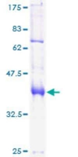 Novus Biologicals Recombinant Human FoxP1 GST (N-Term) Protein 10 &mu;g | Buy Online | Novus Biologicals&trade; | Fisher Scientific