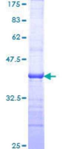 Novus Biologicals Recombinant Human TAF5L GST (N-Term) Protein 10 &mu;g | Buy Online | Novus Biologicals&trade; | Fisher Scientific