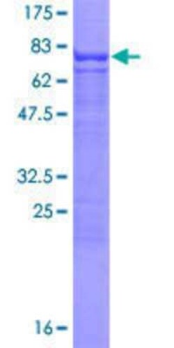 Novus Biologicals Recombinant Human Clusterin-like 1/CLUL1 GST (N-Term) Protein 25 &mu;g | Buy Online | Novus Biologicals&trade; | Fisher Scientific