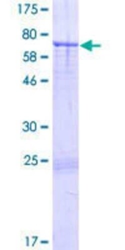 Novus Biologicals Recombinant Human ARRDC2 GST (N-Term) Protein 2 &mu;g | Buy Online | Novus Biologicals&trade; | Fisher Scientific