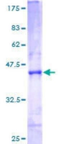 Novus Biologicals Recombinant Human ATP5S GST (N-Term) Protein 10 &mu;g | Buy Online | Novus Biologicals&trade; | Fisher Scientific
