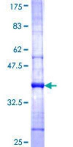 Novus Biologicals Recombinant Human FAM155B GST (N-Term) Protein 10 &mu;g | Buy Online | Novus Biologicals&trade; | Fisher Scientific