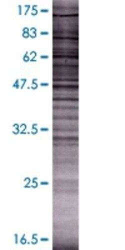 Novus Biologicals Soggy-1/DkkL1 293T Cell Transient Overexpression Lysate 0.1 mL | Buy Online | Novus Biologicals&trade; | Fisher Scientific