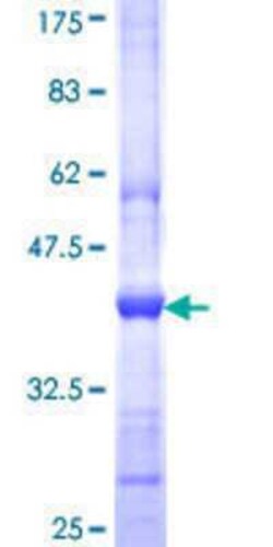 Novus Biologicals Recombinant Human PIB5PA GST (N-Term) Protein 10 &mu;g | Buy Online | Novus Biologicals&trade; | Fisher Scientific