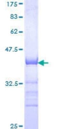 Novus Biologicals Recombinant Human AFF4 GST (N-Term) Protein 10 &mu;g | Buy Online | Novus Biologicals&trade; | Fisher Scientific