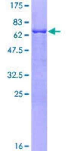 Novus Biologicals Recombinant Human Cytohesin 4 GST (N-Term) Protein 10 &mu;g | Buy Online | Novus Biologicals&trade; | Fisher Scientific