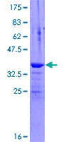 Novus Biologicals Recombinant Human Inversin GST (N-Term) Protein 10 &mu;g | Buy Online | Novus Biologicals&trade; | Fisher Scientific
