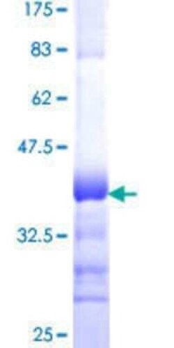 Novus Biologicals Recombinant Human CPNE7 GST (N-Term) Protein 10 &mu;g | Buy Online | Novus Biologicals&trade; | Fisher Scientific
