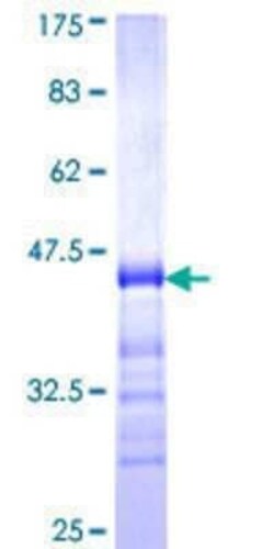 Novus Biologicals Recombinant Human TJP3 GST (N-Term) Protein 10 &mu;g | Buy Online | Novus Biologicals&trade; | Fisher Scientific