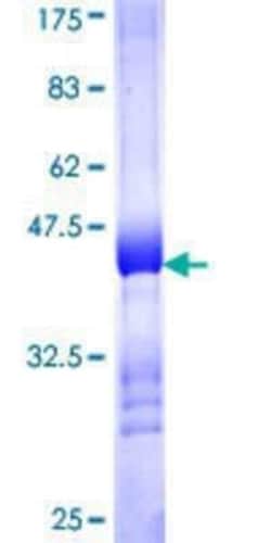 Novus Biologicals Recombinant Human CIDEB GST (N-Term) Protein 10 &mu;g | Buy Online | Novus Biologicals&trade; | Fisher Scientific