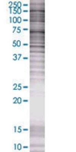 Novus Biologicals STK36 293T Cell Transient Overexpression Lysate 0.1 mL | Buy Online | Novus Biologicals&trade; | Fisher Scientific