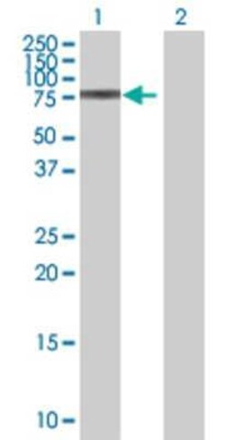 Novus Biologicals ZNF777 293T Cell Transient Overexpression Lysate 0.1 mL | Buy Online | Novus Biologicals&trade; | Fisher Scientific