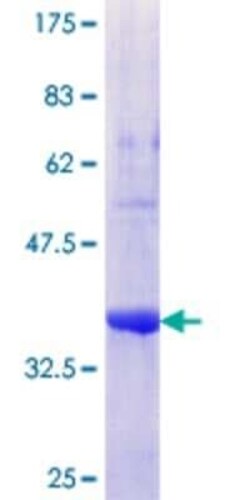 Novus Biologicals Recombinant Human RTDR1 GST (N-Term) Protein 25 &mu;g | Buy Online | Novus Biologicals&trade; | Fisher Scientific