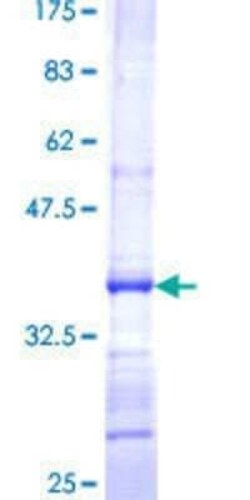 Novus Biologicals Recombinant Human PX19 GST (N-Term) Protein 25 &mu;g | Buy Online | Novus Biologicals&trade; | Fisher Scientific