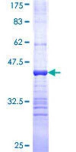 Novus Biologicals Recombinant Human gamma-2 Tubulin GST (N-Term) Protein 10 &mu;g | Buy Online | Novus Biologicals&trade; | Fisher Scientific