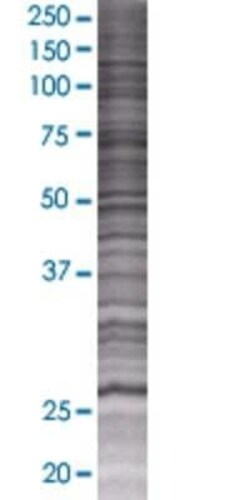 Novus Biologicals ITGB1BP3 293T Cell Transient Overexpression Lysate 0.1 mL | Buy Online | Novus Biologicals&trade; | Fisher Scientific