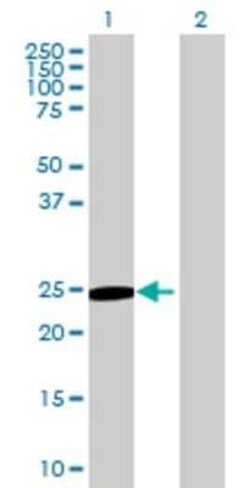 Novus Biologicals ITGB1BP3 293T Cell Transient Overexpression Lysate 0.1 mL | Buy Online | Novus Biologicals&trade; | Fisher Scientific