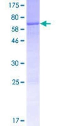 Novus Biologicals Recombinant Human ARHGEF16 GST (N-Term) Protein 10 &mu;g | Buy Online | Novus Biologicals&trade; | Fisher Scientific
