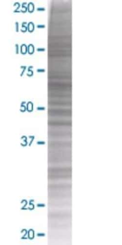 Novus Biologicals&trade;&nbsp;SESN1 293T Cell Transient Overexpression Lysate