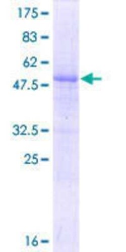 Novus Biologicals Recombinant Human ZNF364 GST (N-Term) Protein 25 &mu;g | Buy Online | Novus Biologicals&trade; | Fisher Scientific