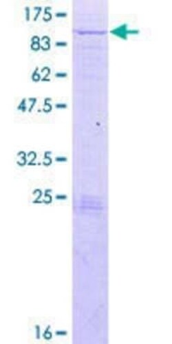 Novus Biologicals Recombinant Human KLHL20 GST (N-Term) Protein 2 &mu;g | Buy Online | Novus Biologicals&trade; | Fisher Scientific
