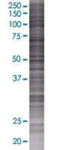 Novus Biologicals DHDH 293T Cell Transient Overexpression Lysate 0.1 mL | Buy Online | Novus Biologicals&trade; | Fisher Scientific