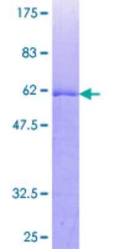 Novus Biologicals Recombinant Human TP53TG5 GST (N-Term) Protein 10 &mu;g | Buy Online | Novus Biologicals&trade; | Fisher Scientific