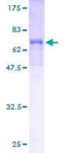 Novus Biologicals Recombinant Human MOCS3 GST (N-Term) Protein 10 &mu;g | Buy Online | Novus Biologicals&trade; | Fisher Scientific