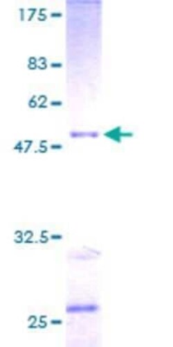 Novus Biologicals Recombinant Human RAB30 GST (N-Term) Protein 2 &mu;g | Buy Online | Novus Biologicals&trade; | Fisher Scientific