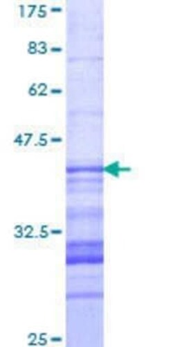 Novus Biologicals Recombinant Human PCDH11X GST (N-Term) Protein 10 &mu;g | Buy Online | Novus Biologicals&trade; | Fisher Scientific