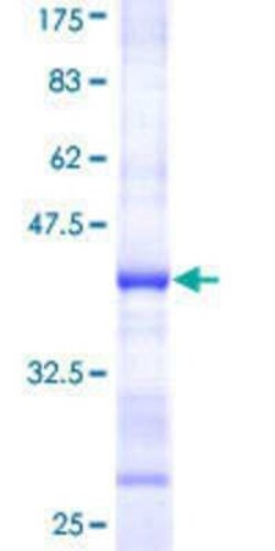 Novus Biologicals Recombinant Human RSK4 GST (N-Term) Protein 10 &mu;g | Buy Online | Novus Biologicals&trade; | Fisher Scientific