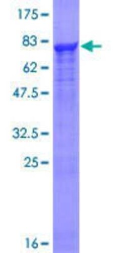 Novus Biologicals Recombinant Human PRP19 GST (N-Term) Protein 10 &mu;g | Buy Online | Novus Biologicals&trade; | Fisher Scientific