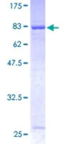Novus Biologicals Recombinant Human Rabex5 GST (N-Term) Protein 2 &mu;g | Buy Online | Novus Biologicals&trade; | Fisher Scientific