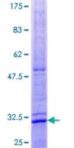 Novus Biologicals Recombinant Human TMEM97 GST (N-Term) Protein 10 &mu;g | Buy Online | Novus Biologicals&trade; | Fisher Scientific