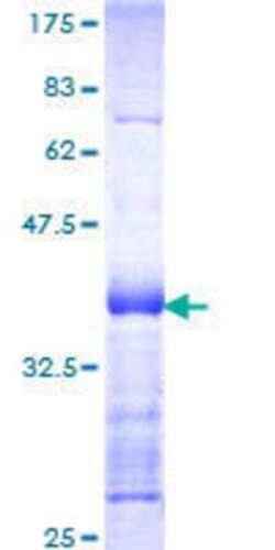 Novus Biologicals Recombinant Human STK39 GST (N-Term) Protein 10 &mu;g | Buy Online | Novus Biologicals&trade; | Fisher Scientific