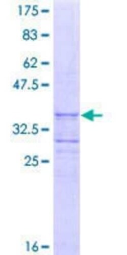 Novus Biologicals Recombinant Human Torsin 1B GST (N-Term) Protein 25 &mu;g | Buy Online | Novus Biologicals&trade; | Fisher Scientific