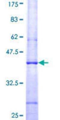 Novus Biologicals Recombinant Human APOBEC3C GST (N-Term) Protein 2 &mu;g | Buy Online | Novus Biologicals&trade; | Fisher Scientific