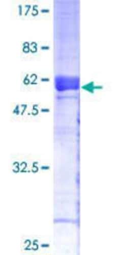 Novus Biologicals Recombinant Human PR48 GST (N-Term) Protein 25 &mu;g | Buy Online | Novus Biologicals&trade; | Fisher Scientific
