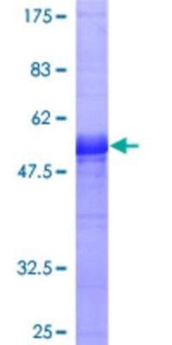 Novus Biologicals Recombinant Human PR48 GST (N-Term) Protein 25 &mu;g | Buy Online | Novus Biologicals&trade; | Fisher Scientific
