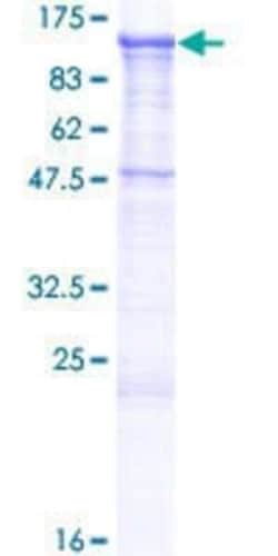 Novus Biologicals Recombinant Human Cadherin-19 GST (N-Term) Protein 10 &mu;g | Buy Online | Novus Biologicals&trade; | Fisher Scientific
